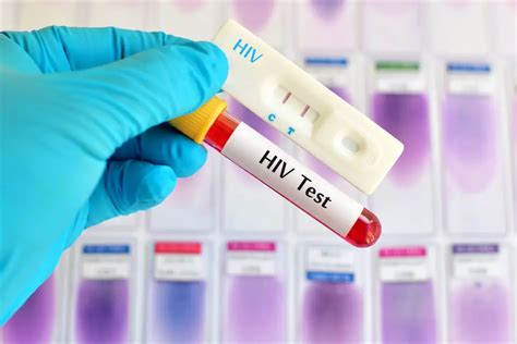 Testing – HIV, STDs and Viral Hepatitis 